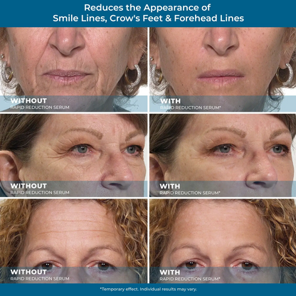 Rapid Reduction Serum -1-Month Supply